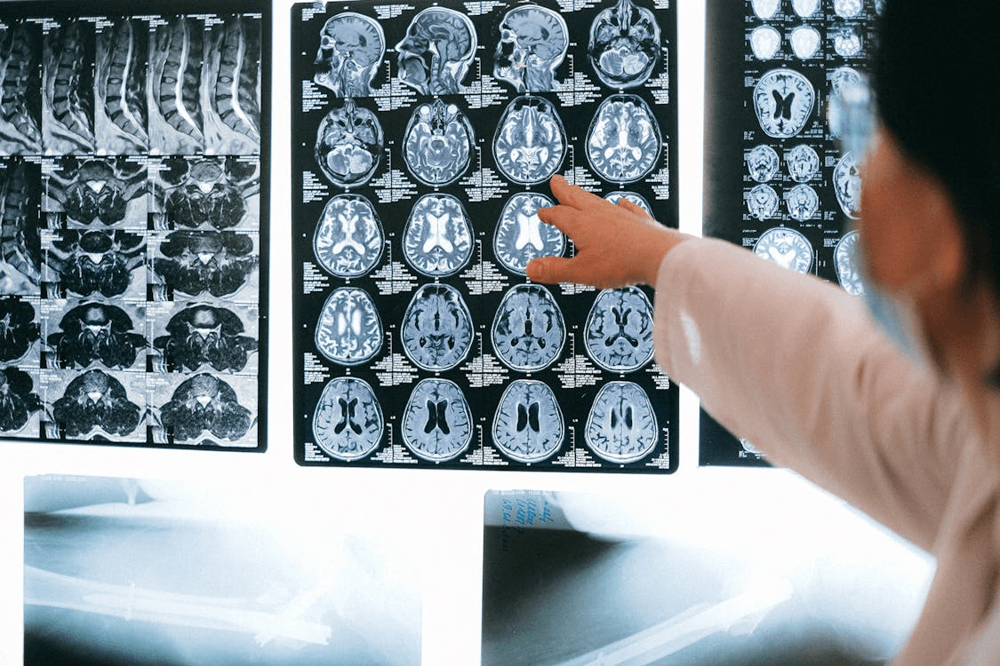 Qu&rsquo;est-ce que la radiochirurgie ?